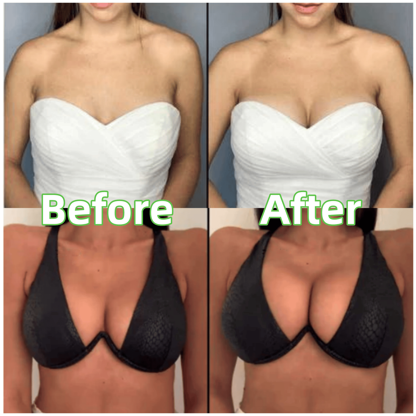 💕LAST DAY SALE !!💕OUFALI Lift Inserts for Bras – Lightly Padded, Double-Sided Adhesive👙 Reusable, Washable • Natural Lift • Seamless Under Clothing ✨