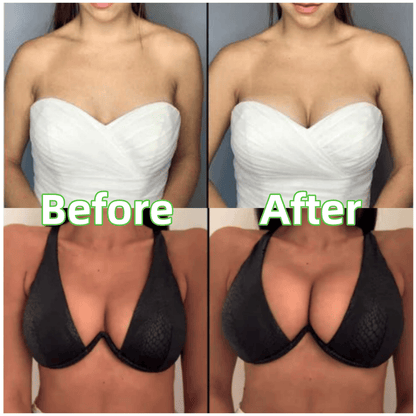 💕LAST DAY SALE !!💕OUFALI Lift Inserts for Bras – Lightly Padded, Double-Sided Adhesive👙 Reusable, Washable • Natural Lift • Seamless Under Clothing ✨