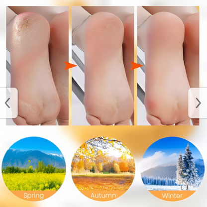Anti-Slip Silicone Gel Moisturizing Foot Spa Socks For Cracked Heels
